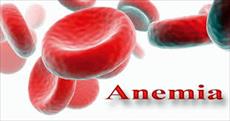 تحقیق کم خونی (Anemia)